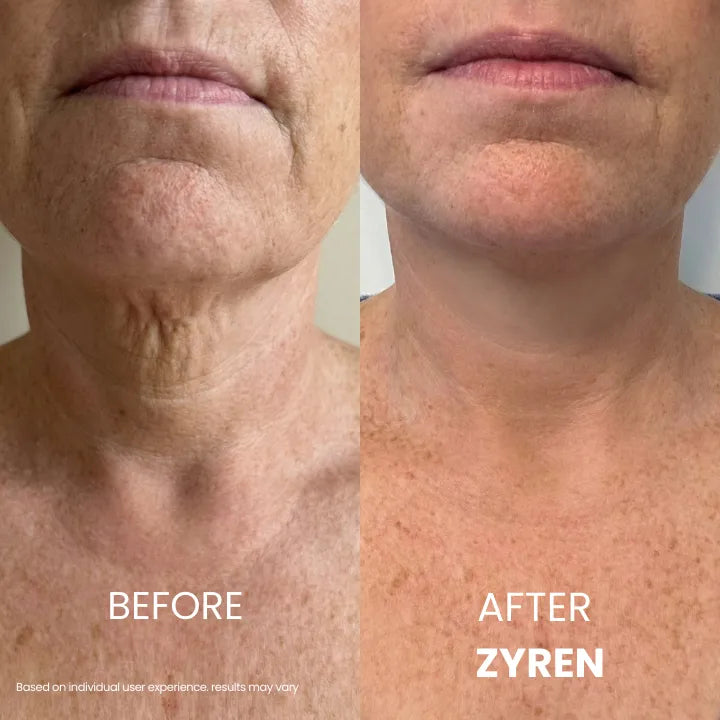 Zynar Tighten & Lift Neck Cream