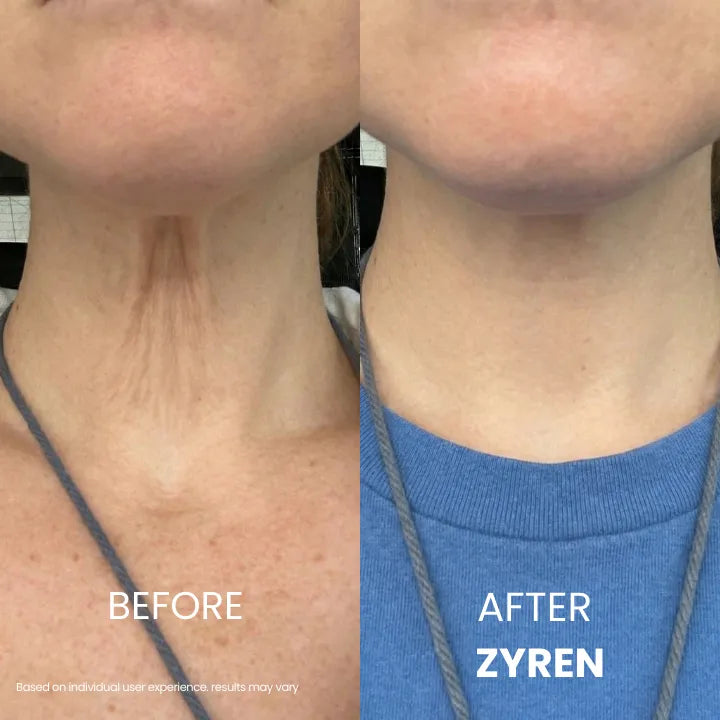 Zynar Tighten & Lift Neck Cream