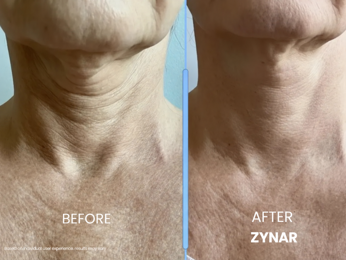 Tighten & Lift Neck Cream
