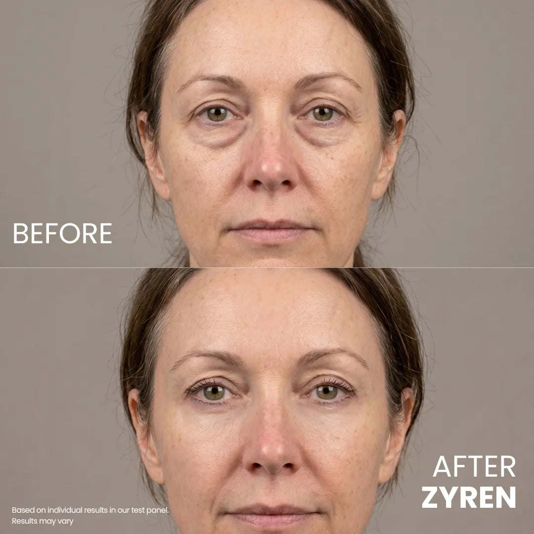 Zynar Contour Lift Eye Cream