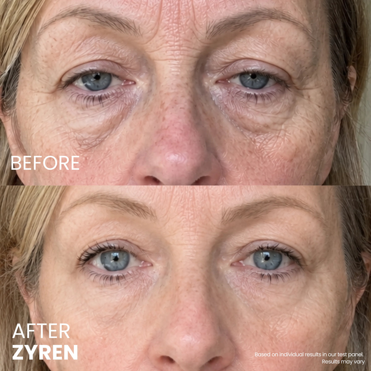 Zynar Contour Lift Eye Cream