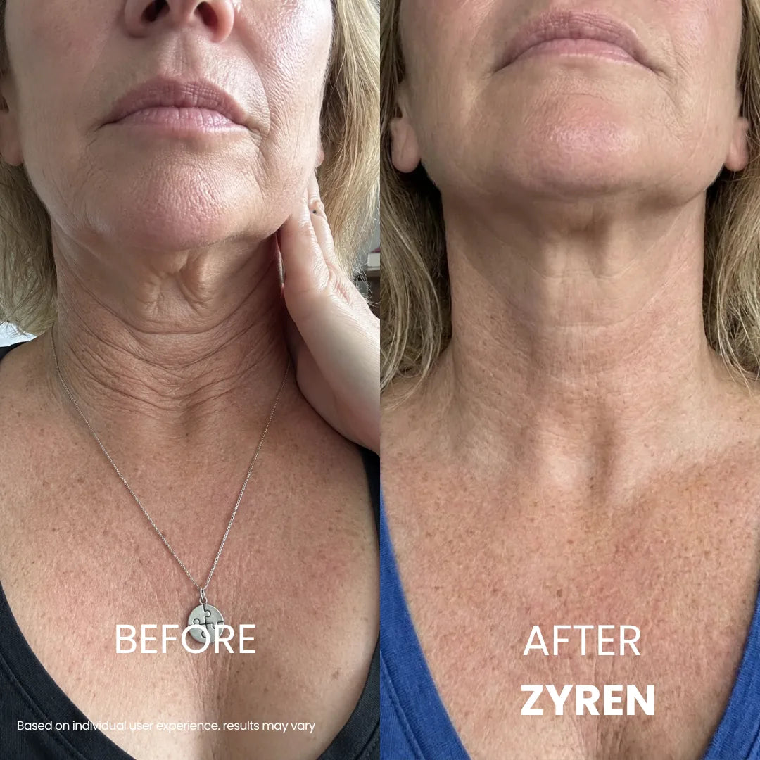 Zynar Tighten & Lift Neck Cream