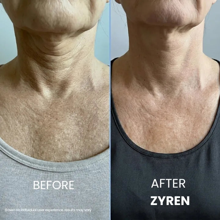 Zynar Tighten & Lift Neck Cream